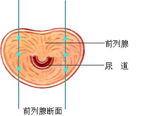 前列腺